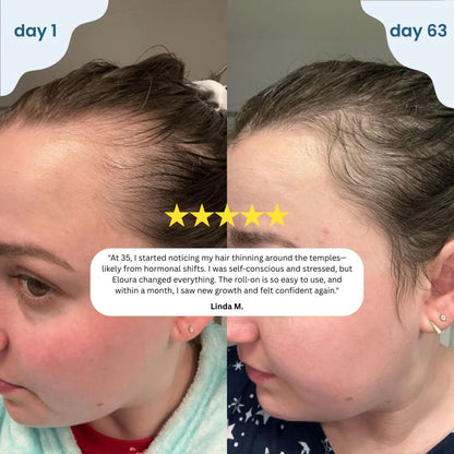 Melanova™ Hair Growth Serum