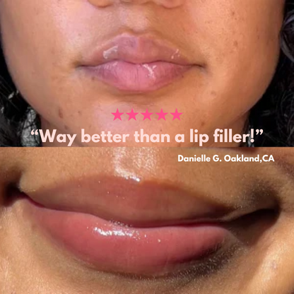 MelaNova™ The Pink Lip Serum